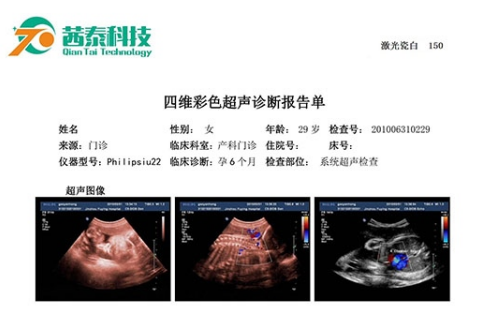 醫(yī)用超聲膠片:揭秘特點(diǎn)和優(yōu)勢